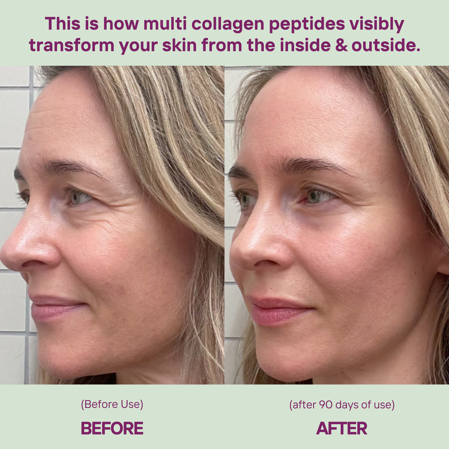 Collagen Peptides