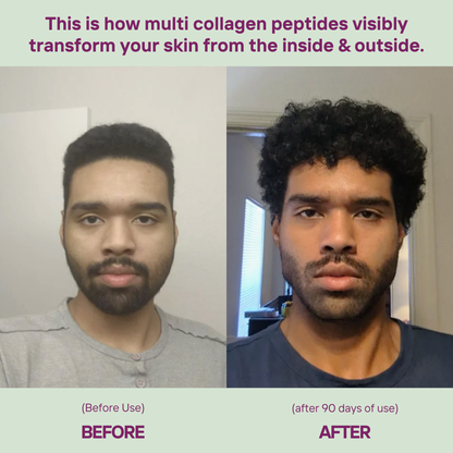 Collagen Peptides