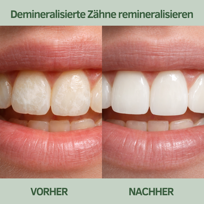 Baumkau™ - Remineralisierender Kaugummi