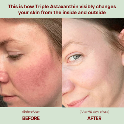 Triple Astaxanthin